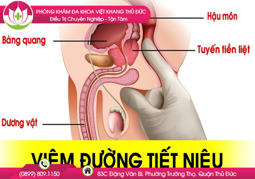 Cách Chữa Viêm Đường Tiết Niệu Ở Nữ Tại Nhà